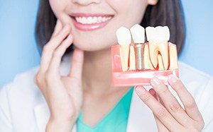 A dentist holding an enlarged dental implant model